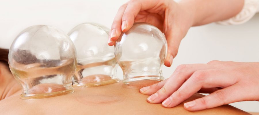 cupping-hor