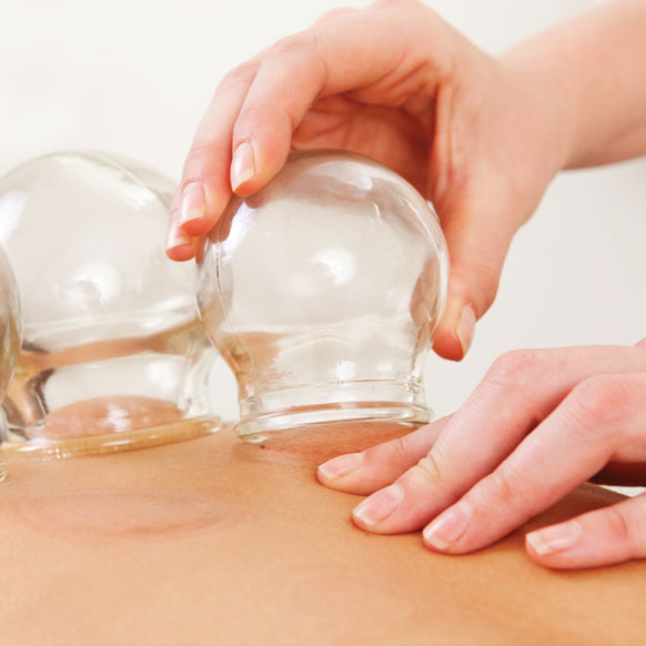 cupping-service